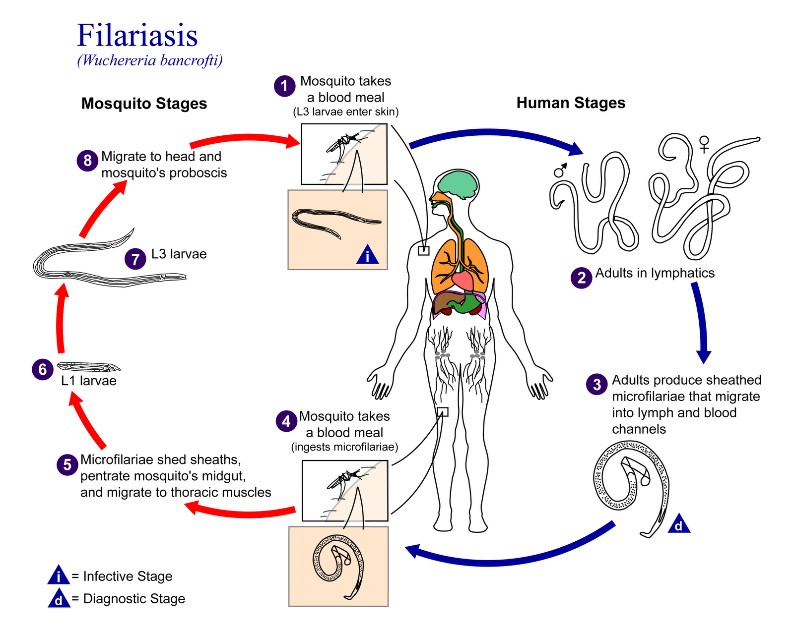 Because the vast majority of infections are caused by W. bancrofti ...