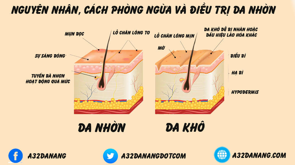 Sự khac biệt giữa da nhờn và da khô