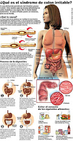 síndrome-intestino-colon-irritable-sii-sci