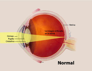 optical shop - enfermedades de los ojos
