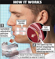 Anti Snoring Mouthpiece