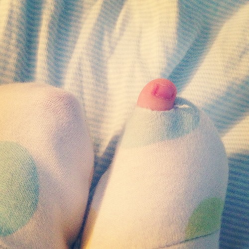 20130317 toe (3)
