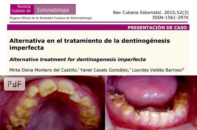 PDF: DENTINOGÉNESIS IMPERFECTA - Alternativa en el tratamiento