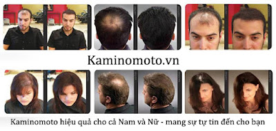 thuốc mọc tóc Kaminomoto