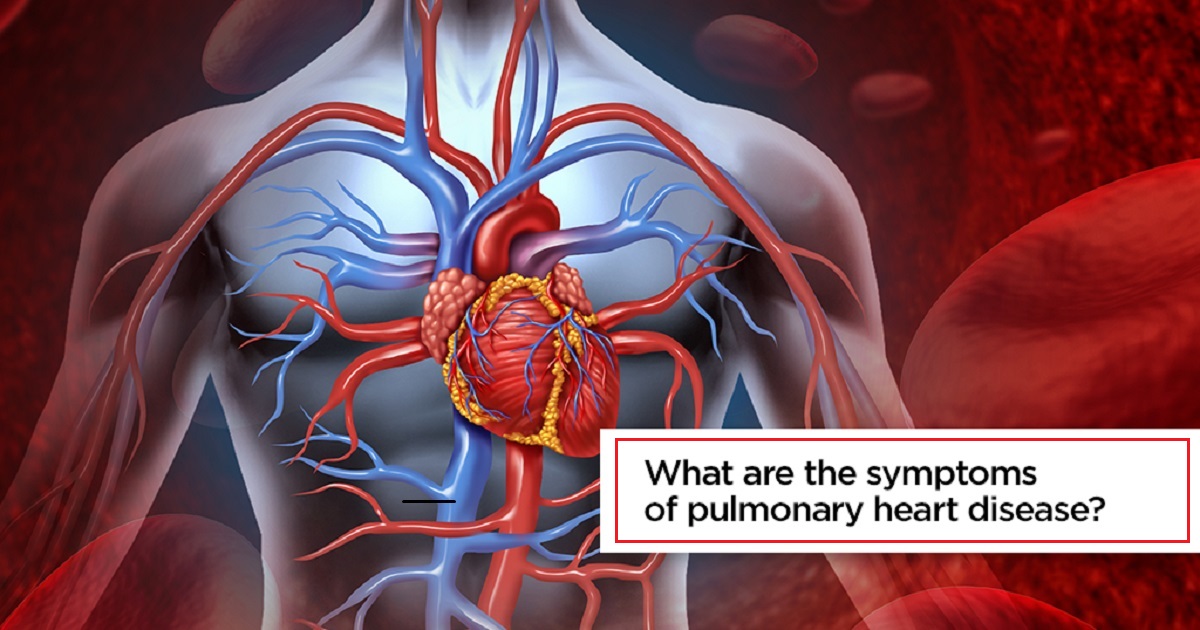 Coronary artery disease