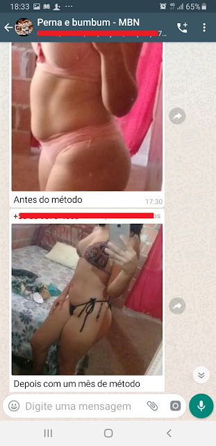 Método Bumbum Na Nuca