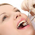 Tìm hiểu nhổ răng hàm trên có đau không 