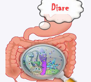 Pengobatan Diare obat diare  obat mencret  penyebab diare  diare pada anak  obat diare anak  diare pada bayi  penyakit diare  obat mencret anak  cara mengobati diare  obat diare alami  bayi mencret  obat untuk diare  obat diare tradisional  obat mencret bayi  mencret pada bayi  obat tradisional diare  bayi diare  obat herbal diare  obat diare bayi  penyebab mencret  pengobatan diare  penyebab diare pada anak  mengobati diare  diare akut  obat alami diare  diare pada balita  cara menyembuhkan diare  obat diare anak 2 tahun  obat mencret balita  obat diare untuk balita