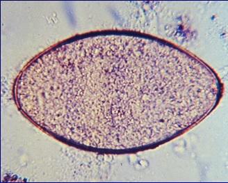 Selamat Ber surfing Ria Laporan Cestoda dan Trematoda