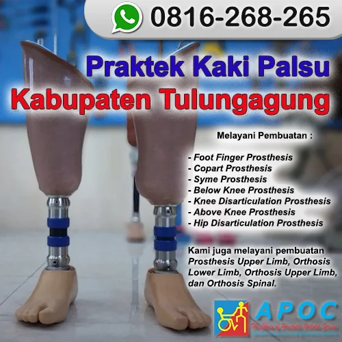Praktek Kaki Palsu Kabupaten Tulungagung >> WA 0816-268-265, Kaki Palsu Robot