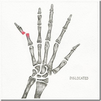 43 dislocated blog