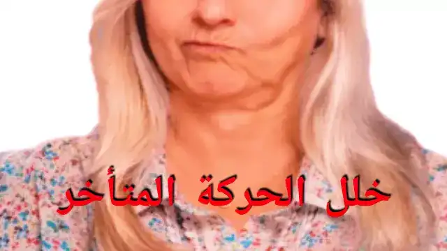 خلل الحركة المتأخر Tardive dyskinesia خلل الحركة المتأخر Tardive dyskinesia