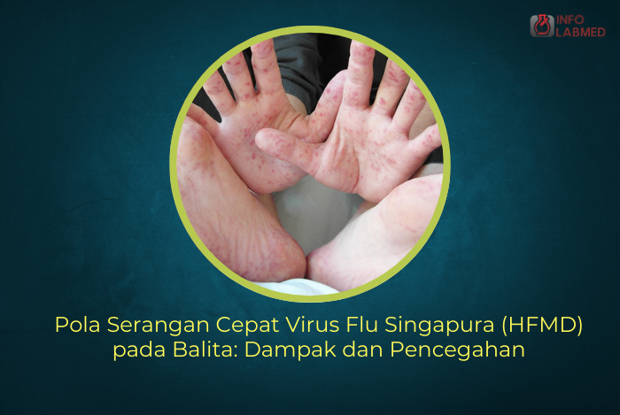 Pola Serangan Cepat Virus Flu Singapura (HFMD) pada Balita Dampak dan Pencegahan