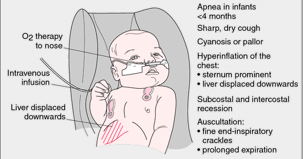 Apa Ubat Hidung Tersumbat - Rawatan r