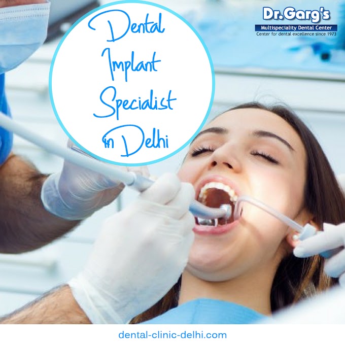 How to Get Dental Implant in Delhi?