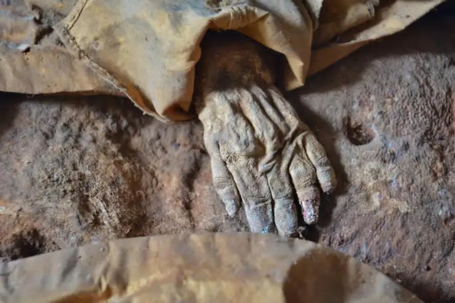 A closer look at the mummified child's hand.  A. G. Nerlich and colleagues/Frontiers