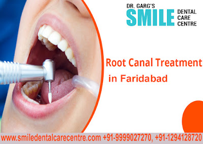 Painless Root Canal Treatment