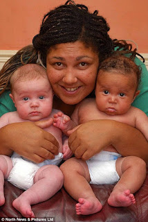 bayi kembar dua ras
