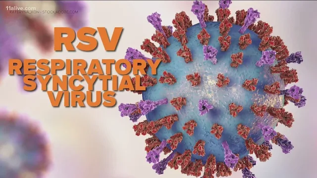 Respiratory syncytial virus infection management