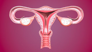 Penyebab rahim kering