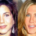 Top 6 Celebrities Before And After Plastic Surgery