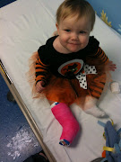 Isabel's Broken Leg :( (img )