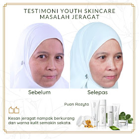 Youth Skincare