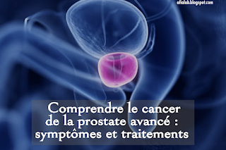 Comprendre le cancer de la prostate avancé : symptômes et traitements