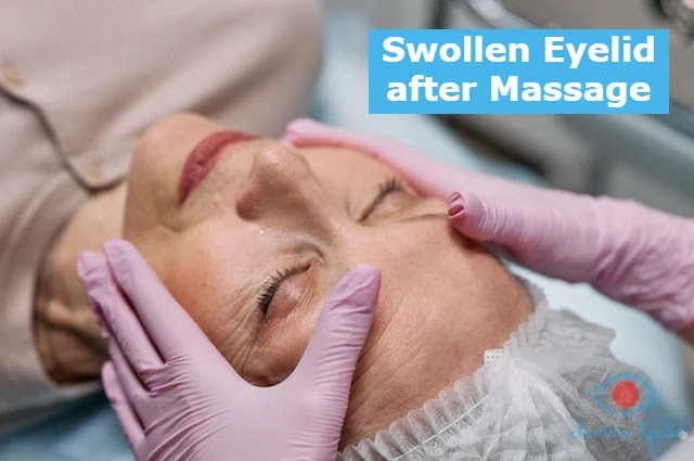 swollen-eyelid-after-massage