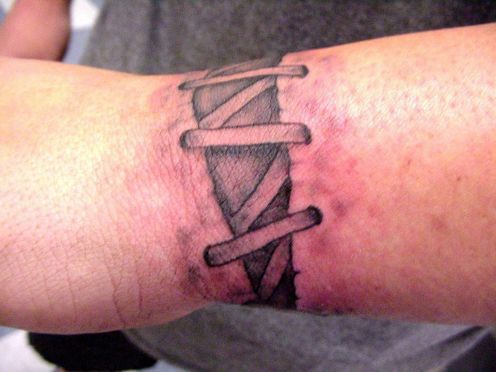 Stitched wrist tattoo.