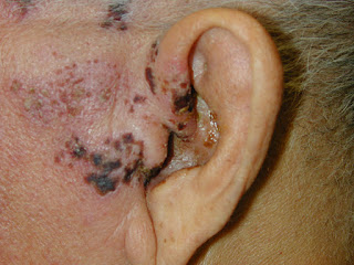 Case of the Day: Ear All About It!