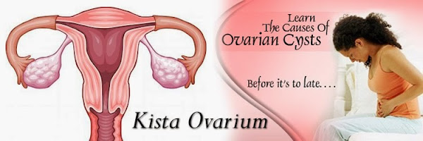 Obat Kista Ovarium Herbal