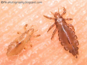 Head Lice Nymph