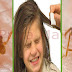 How to Get Rid of Head Lice Fast Naturally Best Home Remedies for Removing of Lice from Hair