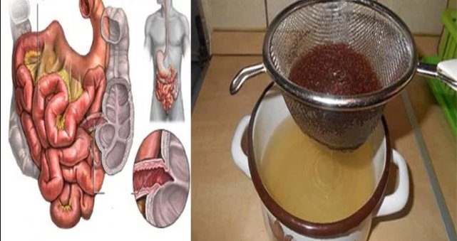 Empty And Cleanse Your Colon Of Toxins With These 3 Ingredients