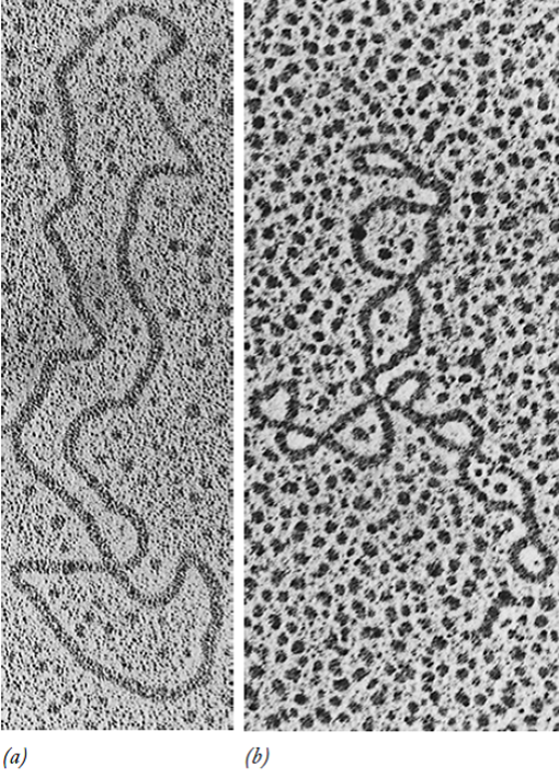 Microfotografía de ADN bacteriano. A la izquierda tenemos una molécula de ADN bacteriano sin enroscarse, y a la derecha tenemos un ADN del mismo peso molecular, pero enroscado.