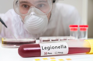 EUA : casos fatais de infecção por Legionela em Spa despertam preocupação na comunidade