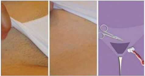 Homemade Remedies to eliminate unwanted Hair