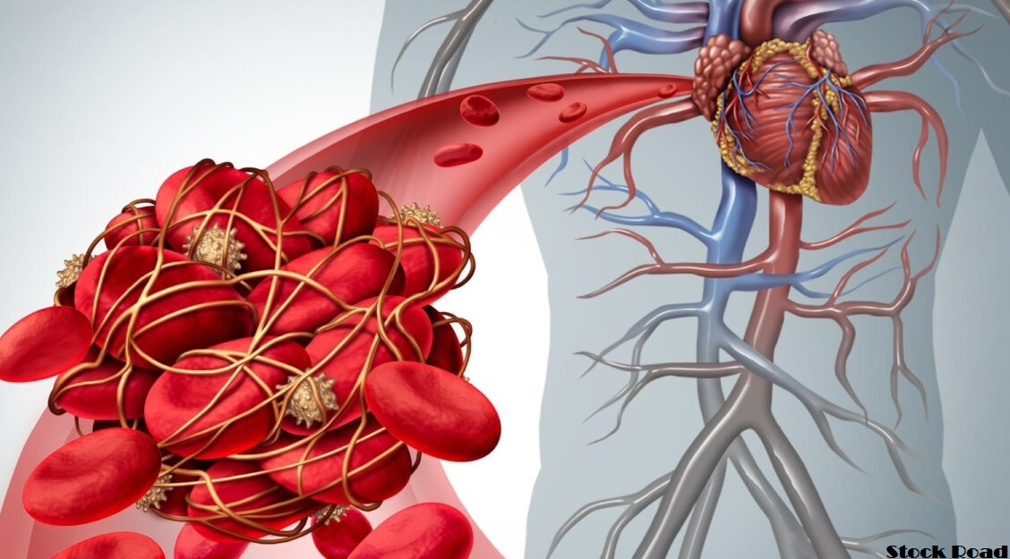  दिल की नसें ब्लॉक होने पर महसूस होते हैं ये लक्षण, न करें इग्नोर  (These symptoms are felt when heart veins are blocked, do not ignore them)