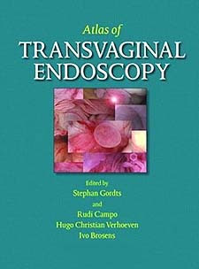 Atlas of Transvaginal Endoscopy