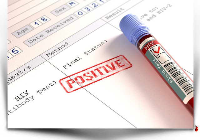 Teste positivo de HIV