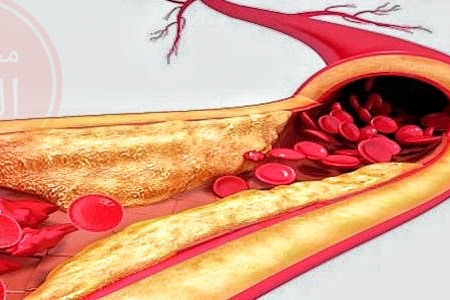 تعرفوا علي : معلومات عن الدهون في الدم