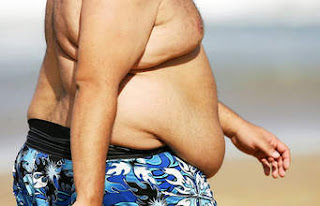 What Causes Overweight and Obesity I? 