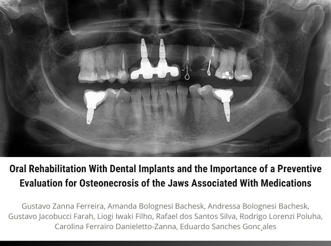 PDF: Oral Rehabilitation With Dental Implants and the Importance of a Preventive Evaluation for Osteonecrosis of the Jaws Associated With Medications