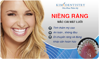 Nha khoa Kim Dentistry là địa chỉ tin cậy giúp bạn có được hàm răng đẹp
