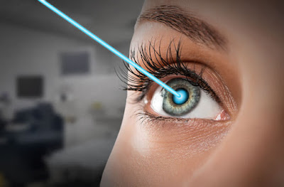 eyes laser treatment in Kuwait
