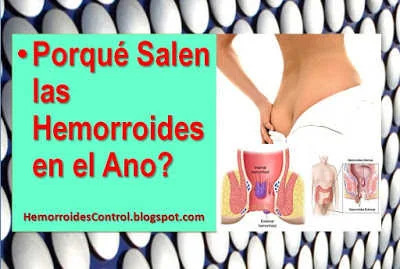 porque-salen-las-hemorroides-en-el-ano