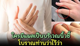 ลองเช็ดดู ใครมีเเผลป็ น บริเวณ นิ้ ว ชี้ โบราณท่ๅนว่ๅไว้ว่าแบบนี้