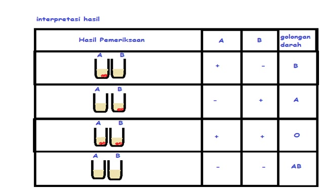 Irens Home Pemeriksaan Golongan Darah Metode Direct Dan