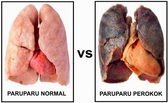 Cara Membersihkan Paru-paru secara Alami